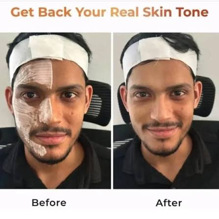 NICONI MEN Enzyme de-tan pack